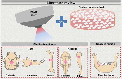  Le Lactide: Un Champion Disparu pour la Reconstrucction Osseuse Moderne !