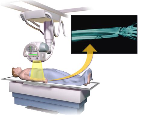 X-Ray Detectors : Des outils révolutionnaires pour l'imagerie médicale et la sécurité !